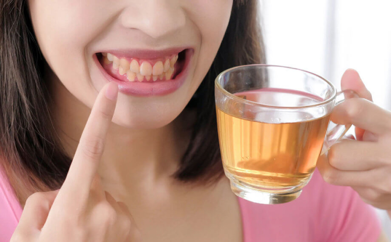 11-popular-foods-and-drinks-that-stain-your-teeth-1.jpg