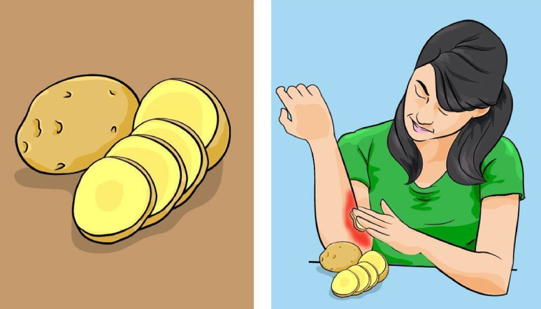 12-amazing-uses-for-potatoes-3.jpg