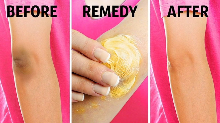 13-amazing-things-you-can-do-with-a-lemon-3.jpg