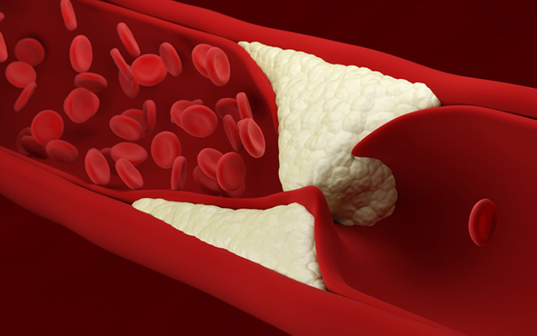 5-unexpected-side-effects-of-frozen-food-3.jpg