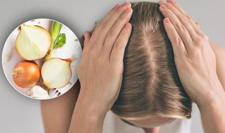 6-ways-to-use-onions-yet-you-dont-know-1.jpg