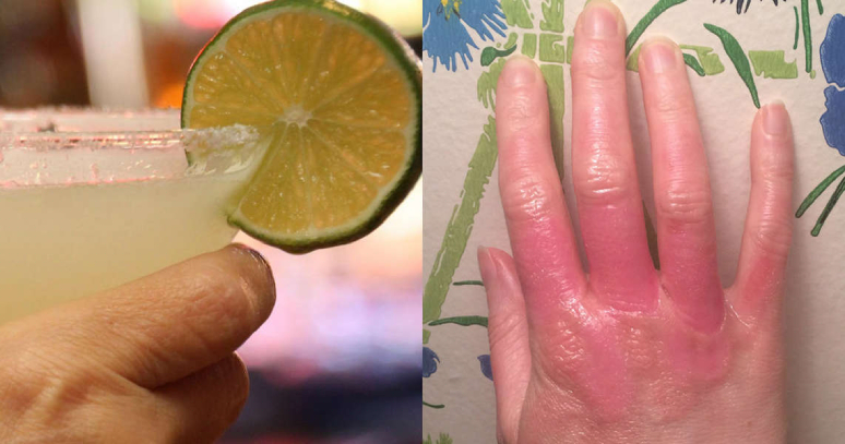 7-side-effects-of-drinking-lemon-water-3.jpg